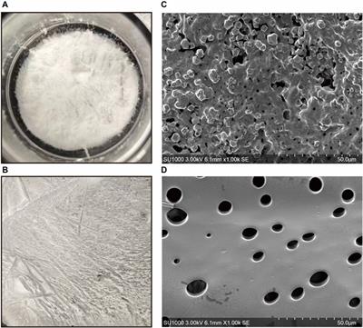 Adipose-derived stem cells derived decellularized extracellular matrix enabled skin regeneration and remodeling